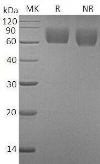 Human FGFR3/JTK4 (His tag) recombinant protein
