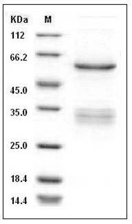 Human SUV420H2 Protein (His & GST Tag) SDS-PAGE