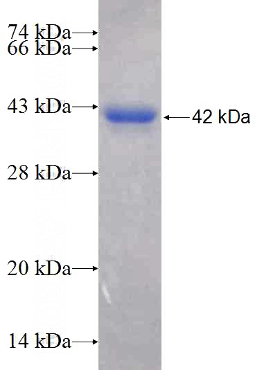 Recombinant Human CCDC92 SDS-PAGE