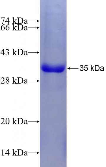 Recombinant Human HSPA1L SDS-PAGE