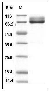 Human IL7RA / CD127 Protein (His & Fc Tag) SDS-PAGE