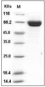 Influenza A H1N1 (A/California/04/2009) Hemagglutinin / HA Protein (His Tag) SDS-PAGE
