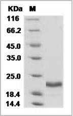 Human IL-28A / IL28A Protein (His Tag)