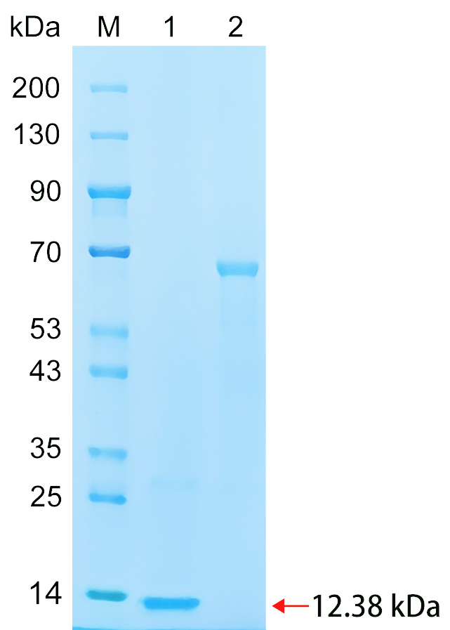 Recombinant TRDV2 protein (His tag) SDS-PAGE