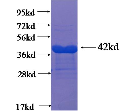 Recombinant human BAALC(Full length) SDS-PAGE