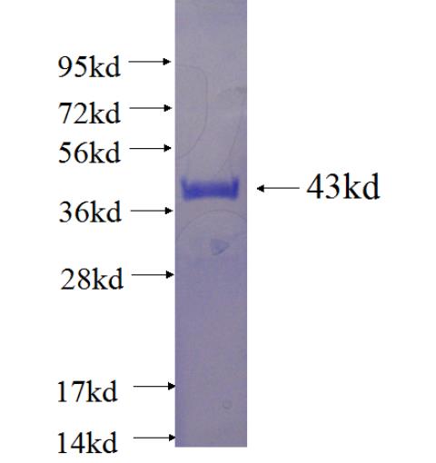 Recombinant human C11orf30 SDS-PAGE