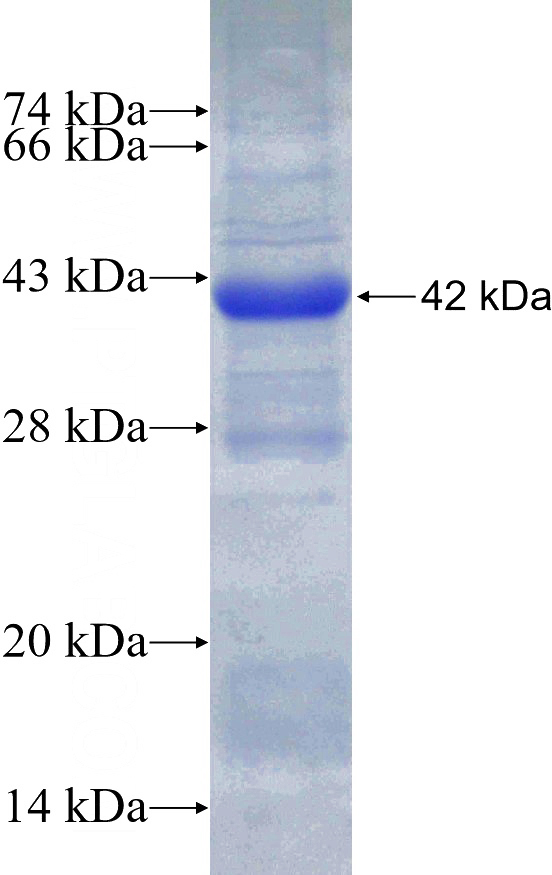 Recombinant Human GUCY2C SDS-PAGE
