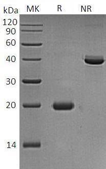 Human S100A7/PSOR1/S100A7C recombinant protein