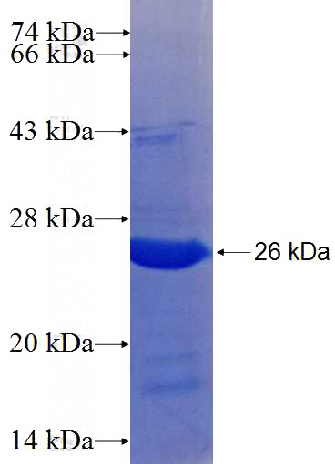 Recombinant Human RRP12 SDS-PAGE