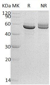 Human PACSIN1/KIAA1379 (His tag) recombinant protein
