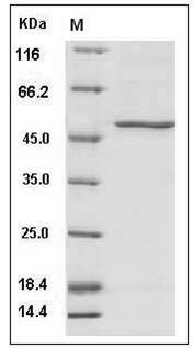 Human PAH / PH Protein (415 Asn/Asp, His Tag) SDS-PAGE