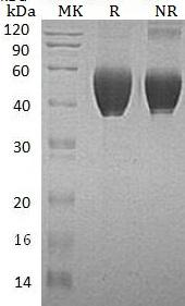 Human FSTL1/FRP (His tag) recombinant protein