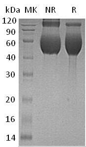 Human CDCP1/TRASK/UNQ2486/PRO5773 (His tag) recombinant protein