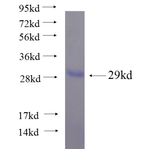 Recombinant human C10orf107 SDS-PAGE