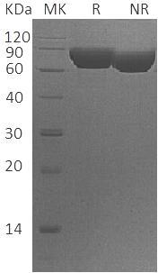 Human FLRT1/UNQ752/PRO1483 (His tag) recombinant protein