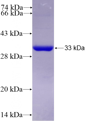 Recombinant Human TTPA SDS-PAGE