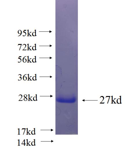 Recombinant human C1orf86 SDS-PAGE