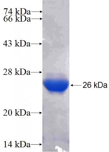 Human DDX5 Recombinant protein (6*His tag)