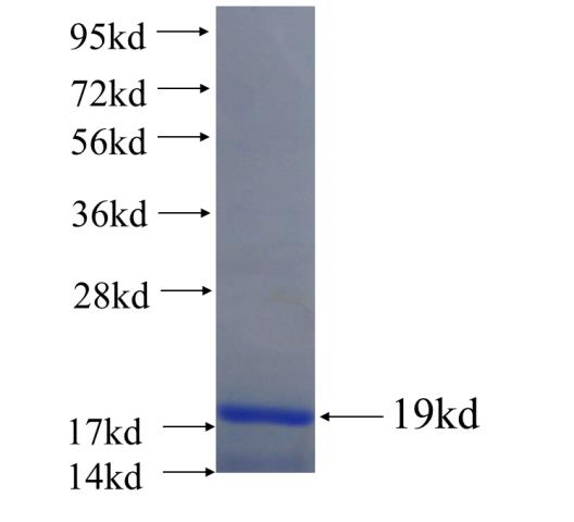 Recombinant human C19orf70 SDS-PAGE