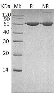 Human PKM/OIP3/PK2/PK3/PKM2 (His tag) recombinant protein