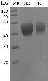 Human IL10RB/CRFB4/D21S58/D21S66 (His tag) recombinant protein