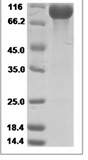 Mouse LAG3/LAG-3/CD223 Protein 14960