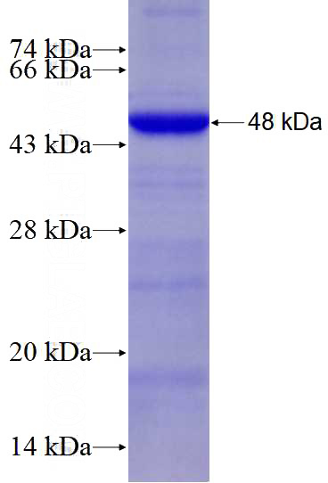 Recombinant Human ST7 SDS-PAGE
