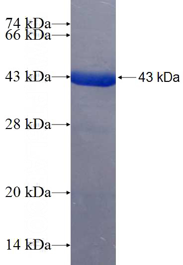 Recombinant Human TTC30A SDS-PAGE