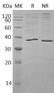 Human AKR1C3/DDH1/HSD17B5/KIAA0119/PGFS (His tag) recombinant protein