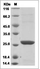 Human Glutathione S-transferase theta-2B / GSTT2B Protein (His Tag)