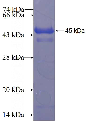 Recombinant Human CCDC135 SDS-PAGE