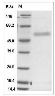 Human FTLS / RSPO2 Protein (186 Leu/Pro, Fc Tag) SDS-PAGE