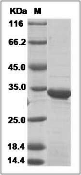 Human DHRS9 Protein (His Tag) SDS-PAGE