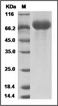 Influenza A H9N2 (A/Chicken/Hong Kong/G9/97) Neuraminidase / NA (His Tag) SDS-PAGE