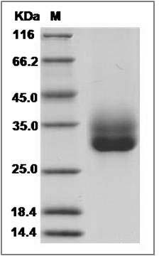 Canine CD137 / 4-1BB / TNFRSF9 Protein (His Tag) SDS-PAGE
