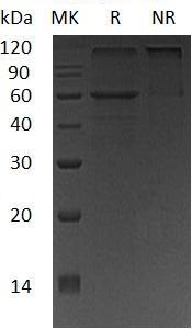 Human TPH2 (His tag) recombinant protein