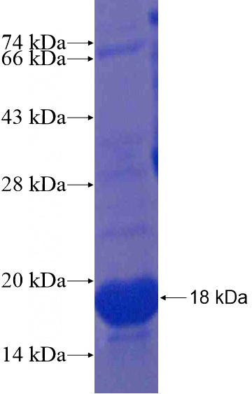 Recombinant Human BLID SDS-PAGE