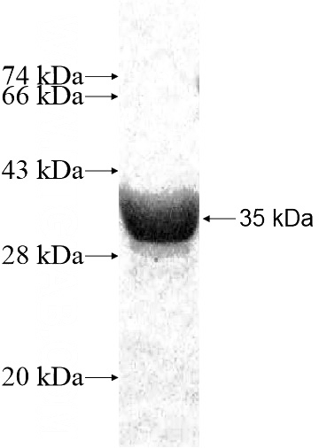 Recombinant Human GNG11 SDS-PAGE