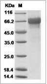 Influenza B (B/Massachusetts/03/2010) Hemagglutinin / HA Protein (His Tag)