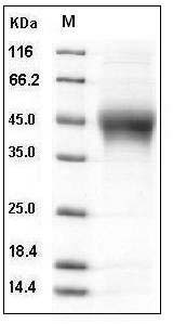 Human IL-21R / Interleukin-21 Receptor Protein (His Tag) SDS-PAGE