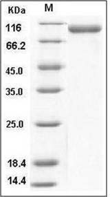 Human CD31 / PECAM1 Protein (His Tag) SDS-PAGE