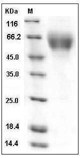 Mouse DR6 / TNFRSF21 Protein (His Tag) SDS-PAGE