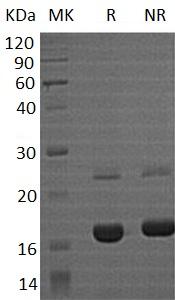 Human MYDGF/C19orf10/IL25 (His tag) recombinant protein