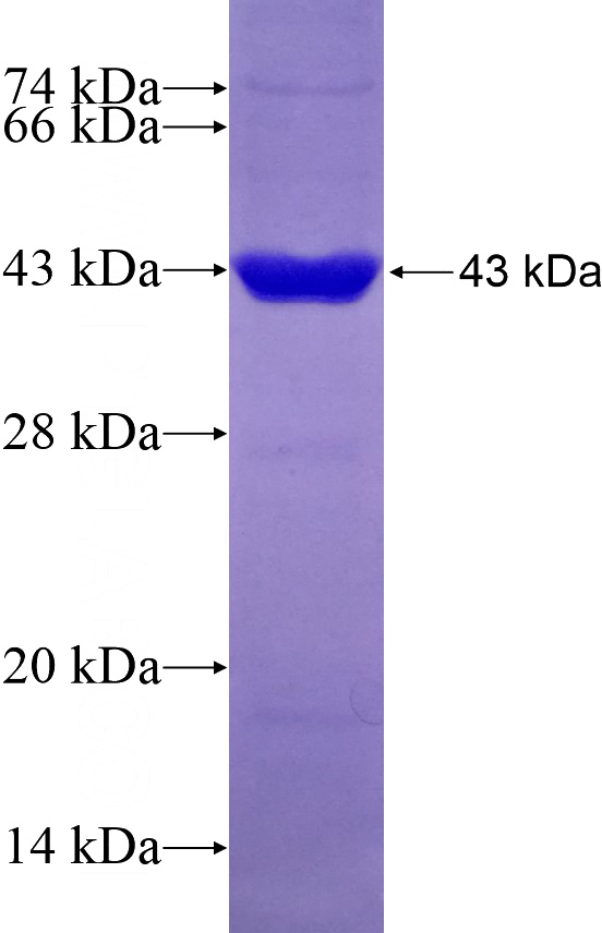 Recombinant Human GMDS SDS-PAGE