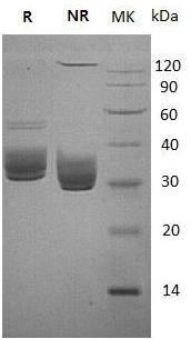 Mouse Btn1a1/Btn (His tag) recombinant protein