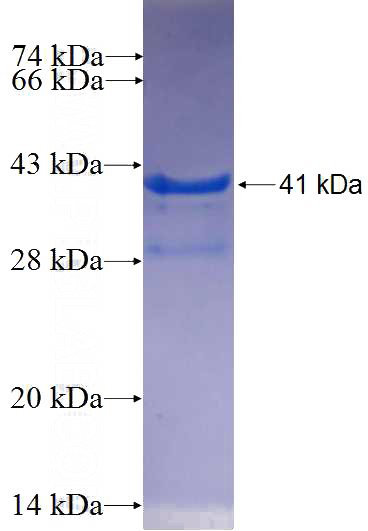 Recombinant Human FCHO1 SDS-PAGE