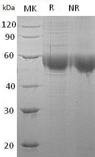 Human PLA2G7/PAFAH (His tag) recombinant protein