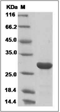 Human RGS1 Protein (His Tag) SDS-PAGE