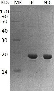 Human LSM1/CASM (His tag) recombinant protein