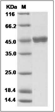 Human Gastric lipase / LIPF Protein (His Tag) SDS-PAGE